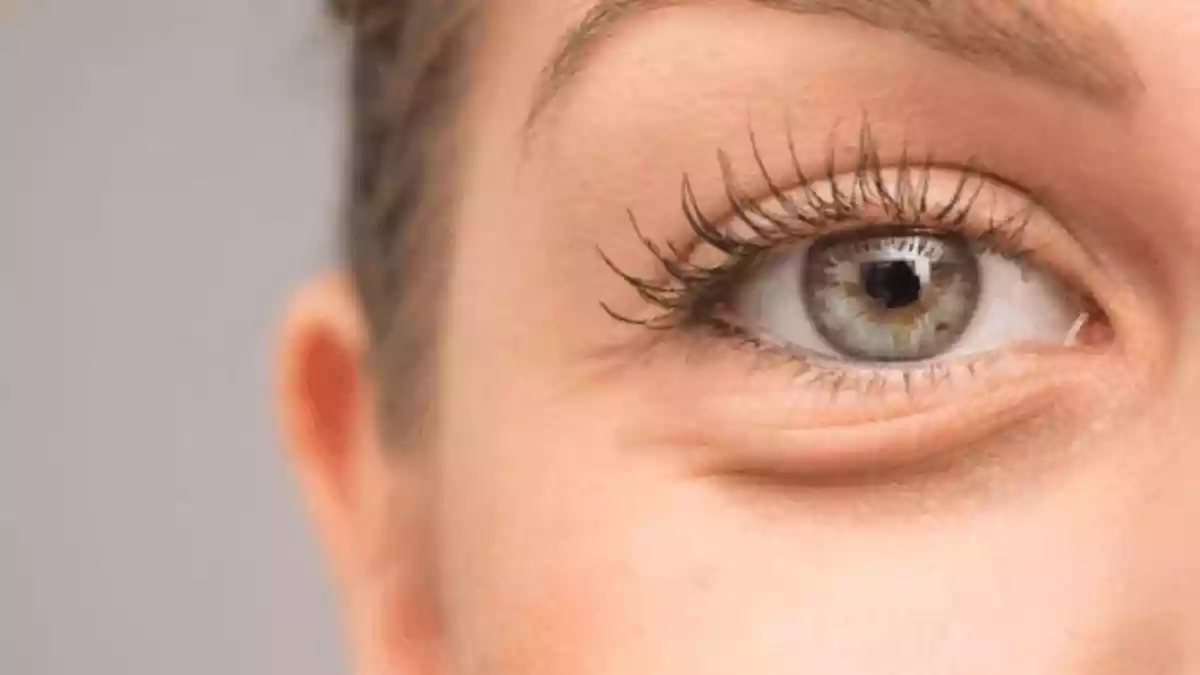 5 Common Eye Infections To Be Wary Of During The Monsoon And How To Avoid Them