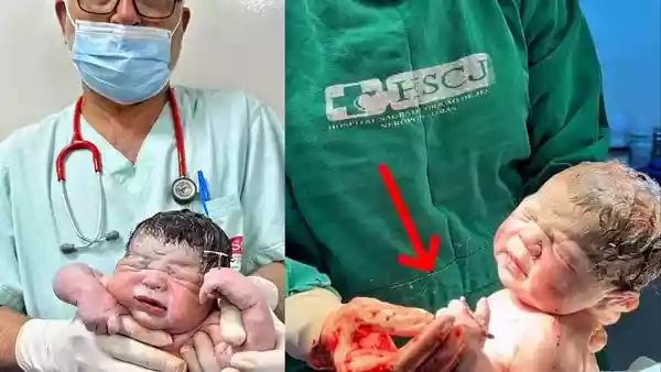A baby born in Brazil has captured attention online after a photo of him holding a contraceptive coil went viral. The device was originally meant to prevent his mother from becoming pregnant. <h4>Mother was using IUD for two years</h4>The baby boy, named Matheus Gabriel, was born at Hospital Sagrado Coração de Jesus in Nerópolis, Goiás, according to the Mirror. His mother, Queidy Araujo de Oliveira, had been using an intrauterine device (IUD), also known as a copper coil, for nearly two years. The device is considered more than 99 per cent effective at preventing pregnancy.