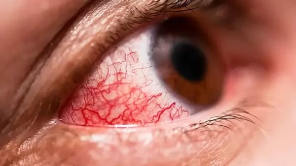 AQI rises post Diwali