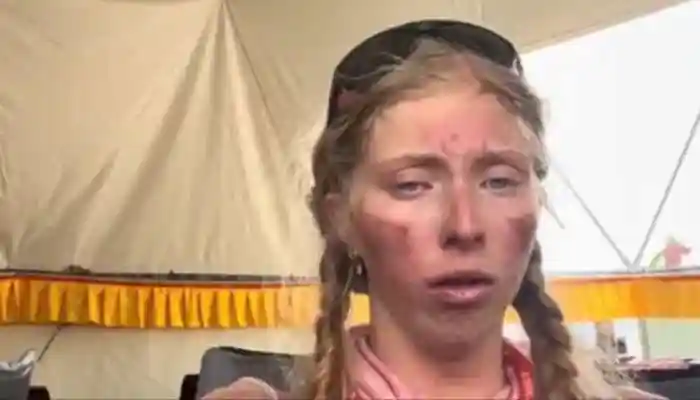Australian Teen Climber Reveals Body's Toll After 3 Days In Everest Death Zone