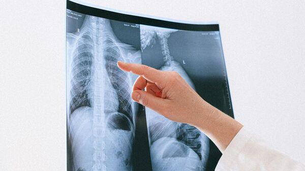 For decades, smoking has been seen as the biggest, and sometimes the only, cause of lung cancer. While it remains the number one risk factor, specialists caution that non-smokers are not immune to the disease. In fact, nearly 20 per cent of lung cancer cases are diagnosed in people who have never smoked in their lives.