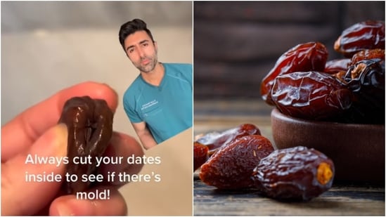 High moisture and sugar content in dates can make them susceptible to mould. Here’s why you must check your dates before consuming them. Do you check your dates before eating them? While dates are a popular choice, whether as a quick snack or a sweet salad topping, they can sometimes harbour hidden mould that often goes unnoticed. Cutting them open before eating increases the chances of spotting any fungal contamination and avoiding potential health risks. Also read | Are dates 'health tonic'? Doctor says eating 2-3 dates a day can transform your body: Here's how