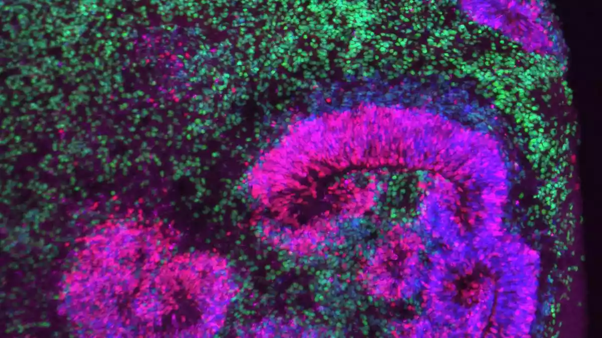 How groundbreaking new brain atlases capture development in motion