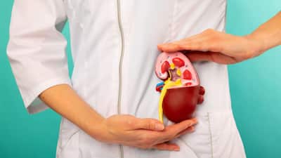 Kidney stones leave individuals with severe abdominal discomfort and pain that must be immediately treated to avoid extensive medical challenges. For individuals who have in the past had renal calculi, the hard deposits of minerals and salts that bind to form stones in the kidneys, there is an additional fear of developing a recurrence.