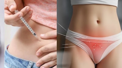 Obesity has become a pressing global health concern, leading many individuals to seek pharmaceutical solutions. Among these, Ozempic, a drug primarily prescribed for type 2 diabetes, has gained massive popularity as a weight-loss aid. However, its growing use has now sparked fresh concerns.