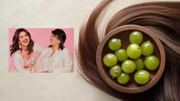 Priyanka Chopra’s mom swears by the benefits of amla to boost hair growth