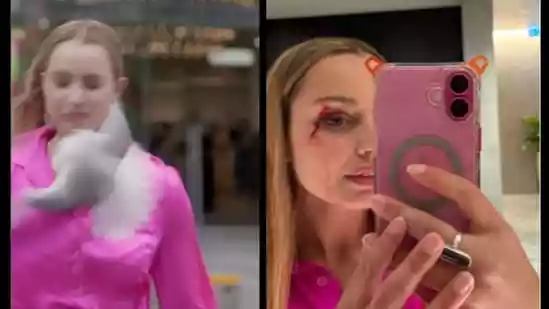 Reporter left with a scar after bird slams into her face on camera