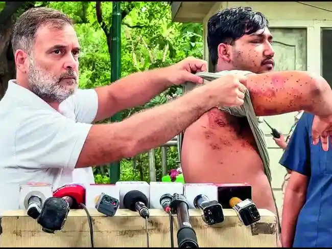 SC directs Delhi govt to treat Jantar Mantar protesters injured in pellet firing