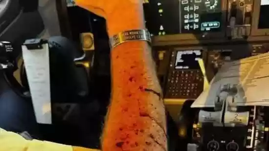 Space debris or hail