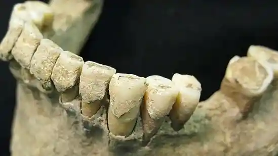 THE ROMANS built pipes from it. Sixteenth-century women coated their faces in powders containing it. And until a phase-out began in the 1970s it was added to petrol to make cars run smoothly. Poisoning by lead is usually thought of as a disease of relatively modern civilisations. Yet in a paper just published in Science Advances Alysson Muotri, a geneticist at the University of California, San Diego and his colleagues show that it was also common among humanity's pre-industrial ancestors. Indeed, the toxic metal may have even helped Homo sapiens to become the planet's sole surviving species of hominin.THE ROMANS built pipes from it. Sixteenth-century women coated their faces in powders containing it. And until a phase-out began in the 1970s it was added to petrol to make cars run smoothly. Poisoning by lead is usually thought of as a disease of relatively modern civilisations. Yet in a paper just published in Science Advances Alysson Muotri, a geneticist at the University of California, San Diego and his colleagues show that it was also common among humanity's pre-industrial ancestors. Indeed, the toxic metal may have even helped Homo sapiens to become the planet's sole surviving species of hominin.