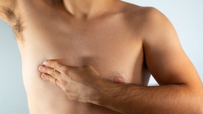 When most people think of breast cancer, they associate it with women. And rightly so, because most medical literature, public campaigns, and even healthcare protocols have largely focused on female patients. Interestingly, history shows that male breast cancer has always existed. Yet, it has remained a silent subject, rarely spoken about and even more rarely researched. For decades, there was little awareness of male breast cancer, to the extent that men often ignored symptoms or dismissed them as non-threatening. This led to delayed diagnoses and poorer outcomes. Today, while we know more than we did in the past, stigma and silence still perpetuate the condition's invisibility.