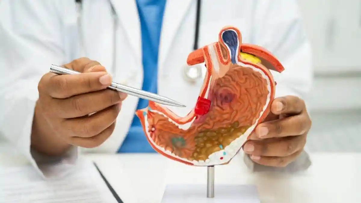 Why Common Symptoms Like Bloating Can Sometimes Signal Stomach Cancer