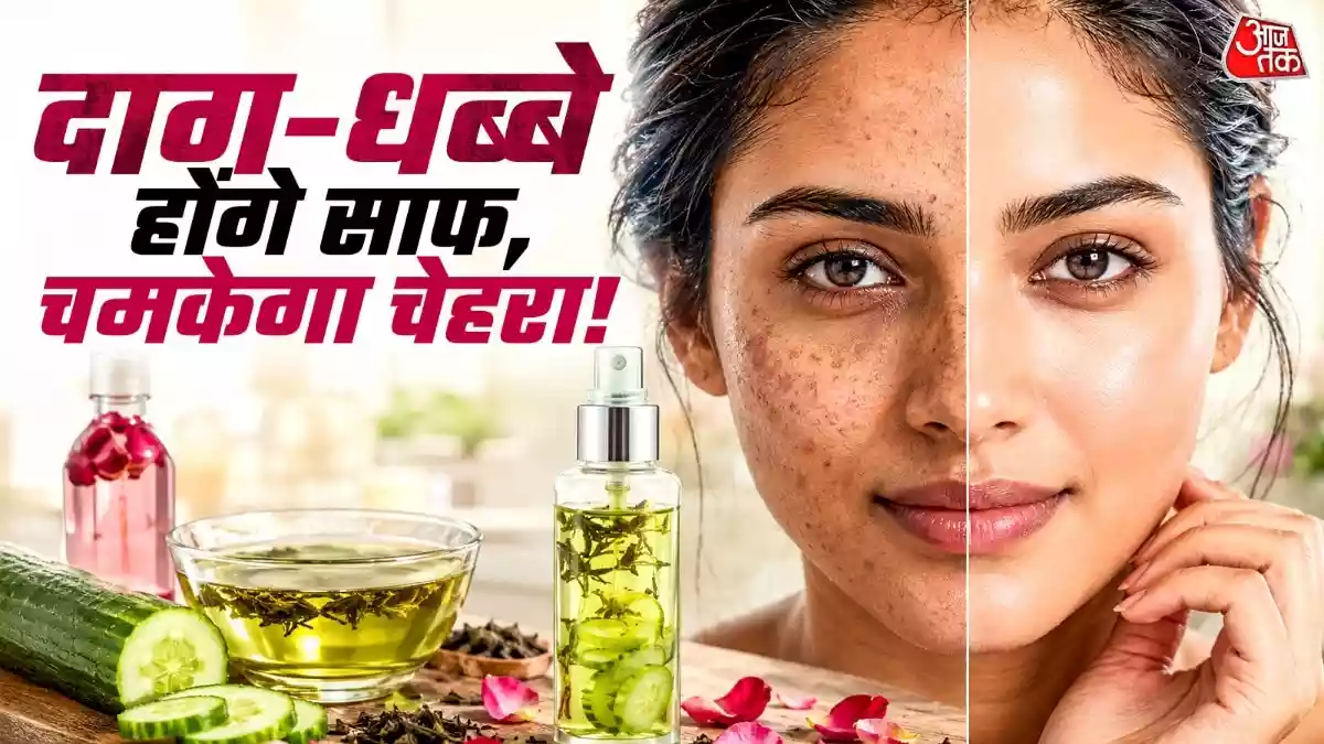 30 में आ गई झाइयां