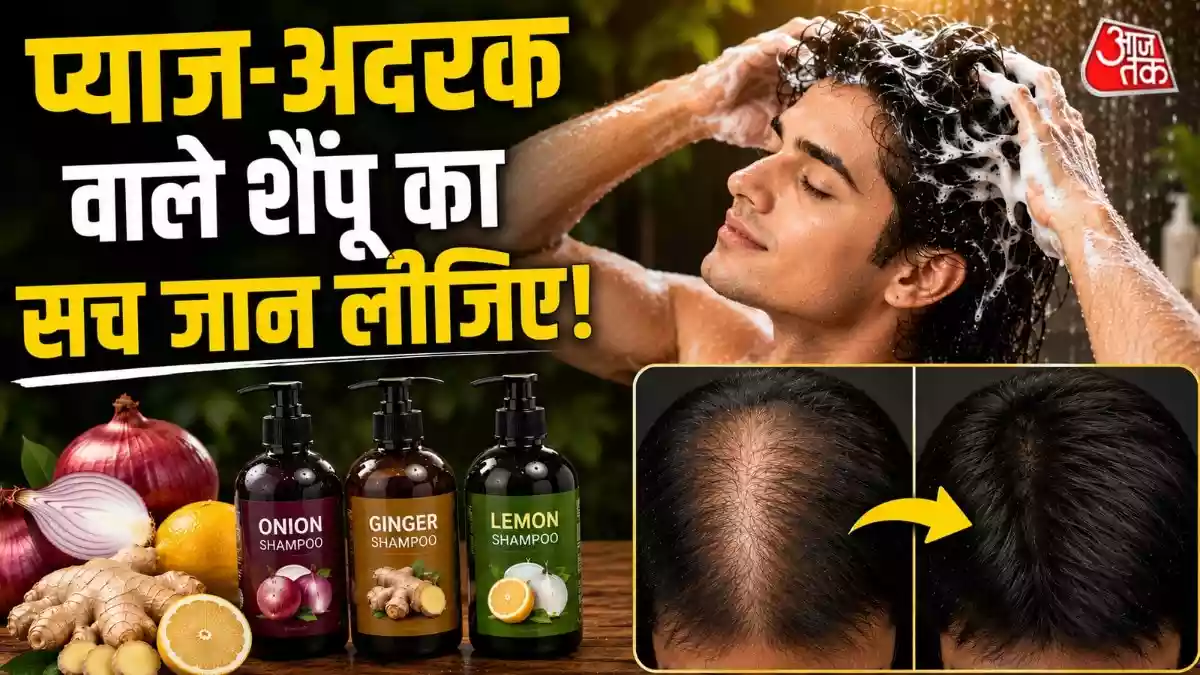 अदरक-प्याज-नींबू वाले हेयर फॉल शैंपू से कितना फायदा