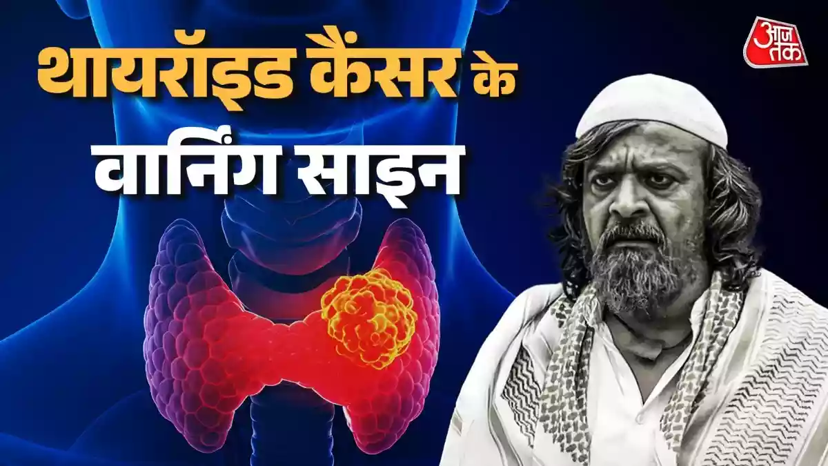 थायरॉइड कैंसर से गई KGF एक्टर हरीश राय की जान