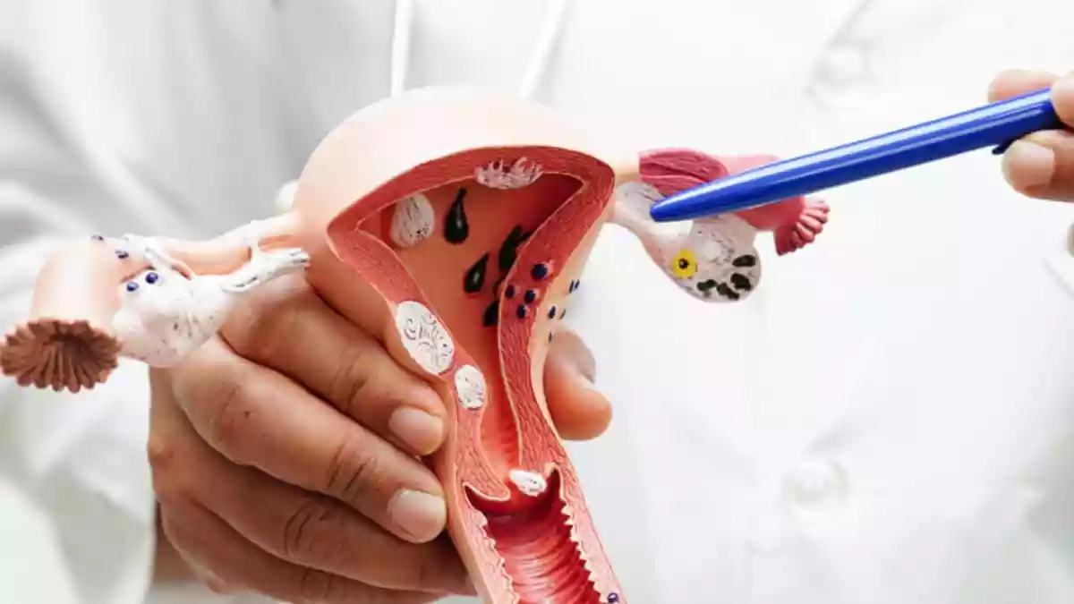 Cervical cancer remains one of the most preventable cancers affecting women, yet it continues to be widely misunderstood. Despite significant advances in