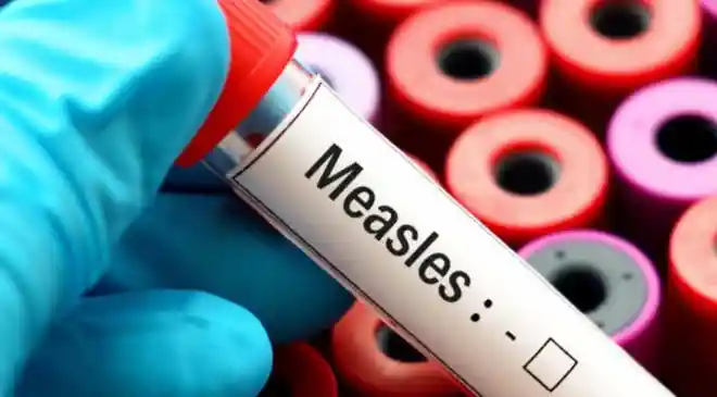 Bangladesh’s deadly measles surge shows how fast outbreaks return when vaccination dips — a warning for India, where immunity gaps could put children at