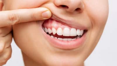 A growing body of research is drawing new attention to the mouth–heart connection. While brushing and flossing are often seen as just cosmetic routines, a recent study from Tampere University in Finland highlights how oral bacteria may play a far more dangerous role – contributing to heart attacks. Researchers discovered bacterial DNA lodged inside coronary plaques, reframing the way we look at both oral hygiene and cardiac prevention.