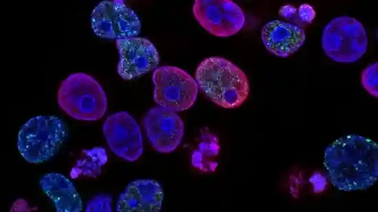 A new drug targets one of cancer’s master switches