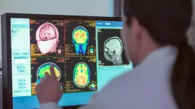 The brain goes through five distinct phases in life, with key turning points at ages nine, 32, 66 and 83, scientists have revealed. Around 4