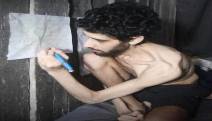 As a starving Israeli hostage pleads on camera, the nation erupts in fury – fuelling mass protests and intensifying pressure on Netanyahu to act. New Delhi: Tel Aviv's summer sky darkened with rage and grief on Sunday night. Crowds swelled in Rabin Square. Hoarse with frustration, their eyes were fixed on the giant screens playing something no one could process. It was a new hostage video from Gaza, showing two emaciated Israeli captives.