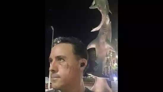 A marine biologist who survived a brutal shark attack in Costa Rica now says he wants to meet the same animal again. Mauricio Hoyos