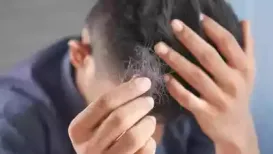 <h4>Can hair loss be predicted before it starts? Plastic surgeon Dr Debraj Shome reveals</h4> Published on: Jul 27, 2026