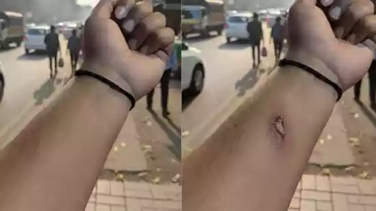 AI technology has advanced so rapidly that even simple photo edits are starting to look completely real. Google's updated Nano Banana AI image generator