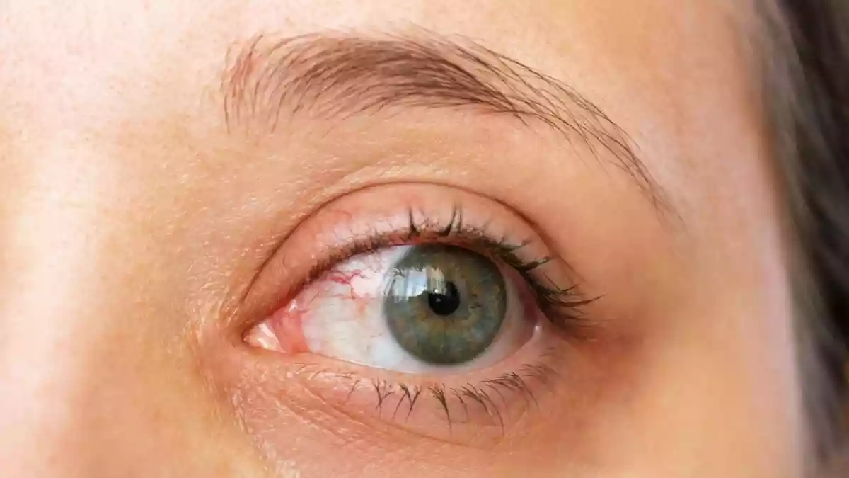 After using your phone, laptop, digital tablet, etc for an extended period of time, dealing with blurred vision is common for a lot of people