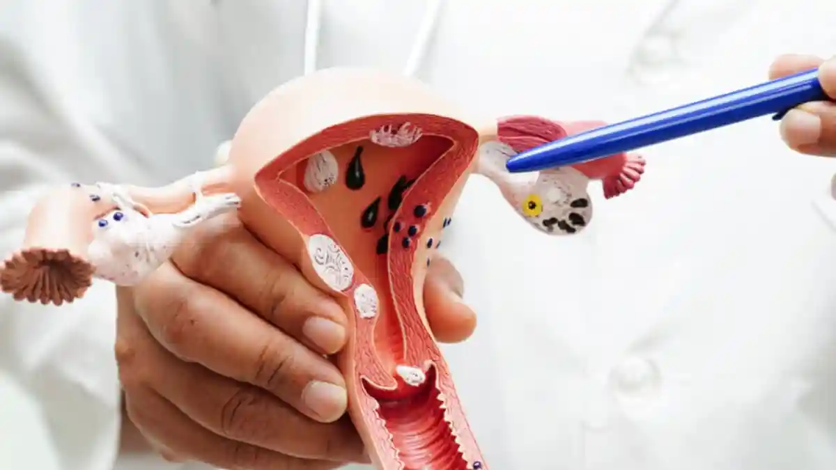 Cervical cancer remains one of the most common cancers among women, yet it is also one of the most preventable. A simple test known as a Pap smear is the most