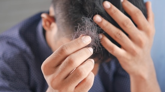 From types to avoiding self-medication, here’s all that you need to know about the hidden reason that could be causing hair loss. Stress can take a serious toll on hair health. Elevated cortisol levels caused by chronic stress are often linked to hair loss. However, before attributing thinning hair or hair fall solely to stress, it’s important to consider another possible cause, alopecia.