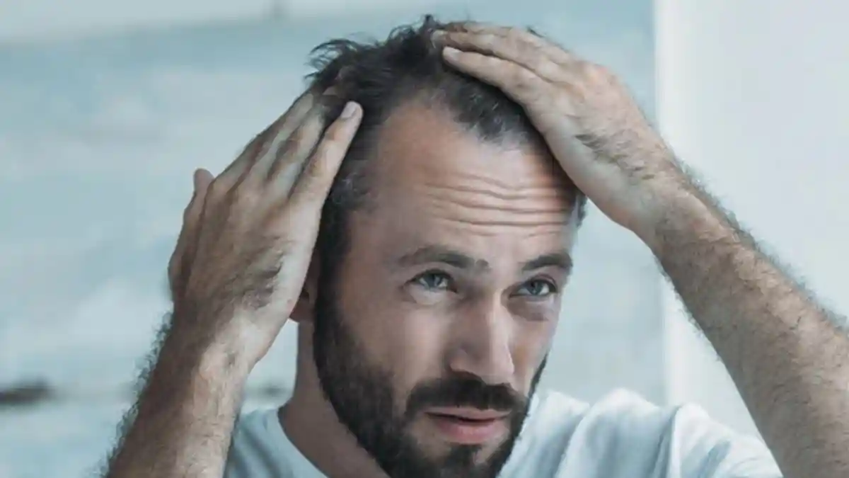 Hair loss is no longer a concern reserved for men in their 30s or 40s. Increasingly, it is showing up much earlier, sometimes even before the age of 25