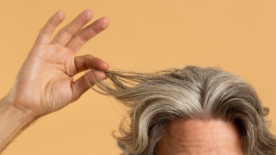 Grey hair isn't just a sign of ageing anymore. Increasingly, people in their 20s and 30s are noticing strands of grey, which can be concerning and confusing. To understand why premature greying is on the rise and how it can be managed, Dr Anil KV Minz, Senior Dermatologist, Genesis Skin and Hair Clinic, Faridabad, shares with HT Lifestyle the key causes and tips to slow down the process. <strong>(Also read: </strong><strong>AIIMS dermatologist rates popular drinks from matcha, bubble tea to soda for skin health: Guess which one tops the list</strong><strong> )</strong>