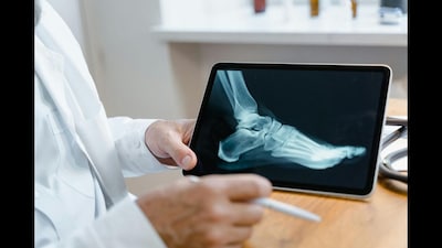 Gut, Nutrition And Bones