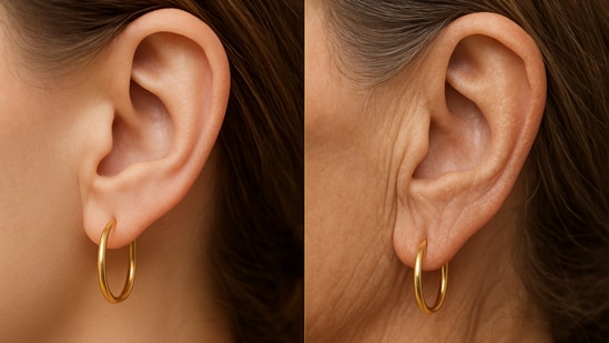 In a new video, dermatologist Dr Sam Ellis has shared a fairly simple solution for a problem that impacts almost all the women in the world: earlobes sagging with age. She highlights that as people age, earlobes tend to become saggier and looser. This can lead to earrings looking 