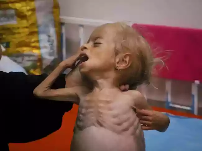 Iran war may push 45 million people into acute hunger by June