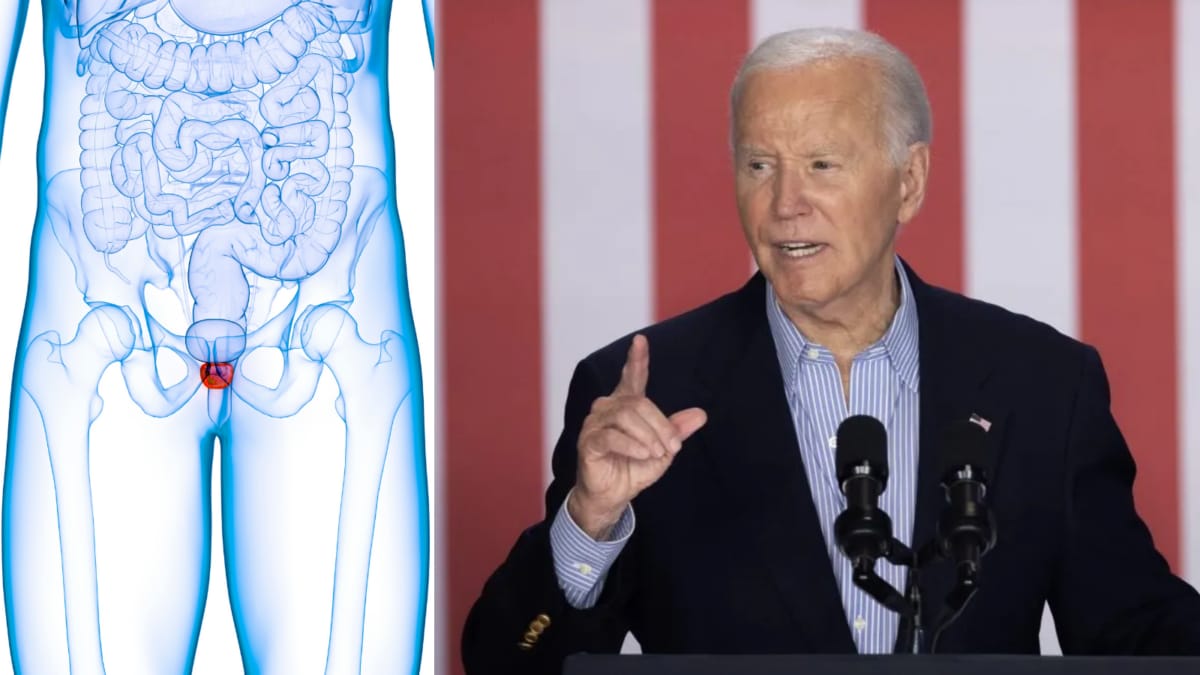 Joe Biden’s Prostate Cancer Spreads To Bones