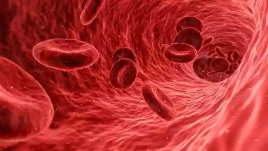 Longevity doctor shares 4 steps to reverse plaque buildup in arteries