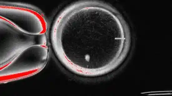 MANY COUPLES struggle to conceive. In vitro fertilisation (IVF) can help some, but if the woman has no usable eggs to fertilise, they must either give up or use an egg donor. Researchers have therefore worked for years to create eggs for women who lack them. So far they have succeeded only in mice, but that could be about to change. In a paper just published in Nature Communications, a group of researchers report they have—albeit imperfectly—created fertilisable human eggs from skin cells.