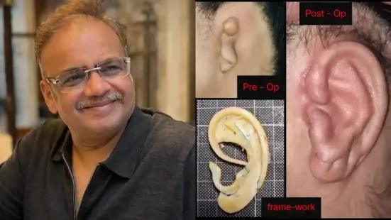 <strong>Microtia Awareness Day 2025: </strong>Every year on November 9, Microtia Awareness Day is observed to raise awareness about microtia