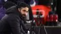 Manchester United head coach Ruben Amorim says criticism from legendary former players is to be expected because the club is 