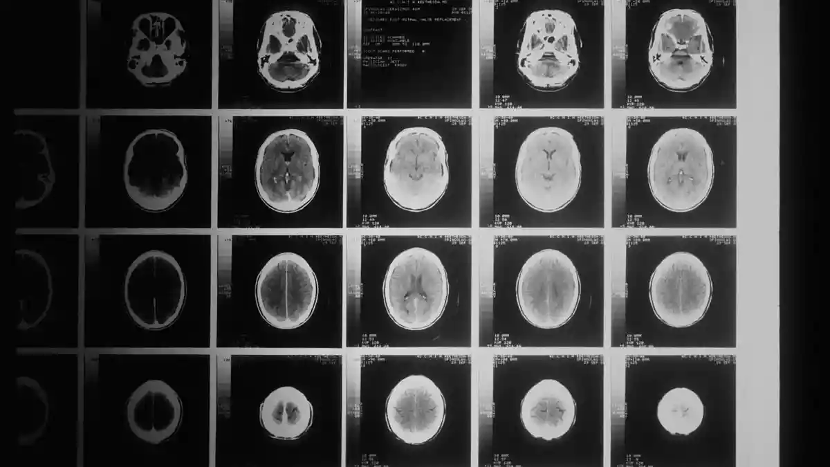 Psychedelics are revealing how the brain builds the sense of self