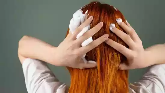 Blame it on the hot water showers or the moisture-less cool winds, dandruff is a common hair care issue. Moreover, those white flakes on your shoulder or