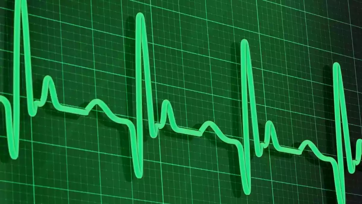 A slower heart rate is often associated with good cardiovascular fitness. However, as Dr. Naveen Bhamri, MD (Medicine), DM (Cardiology)