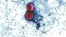 HomeNext<h4>Thousands sickened with ‘explosive’ diarrhoea in the US: The parasite that thrives on salad greens & fruits</h4><h4>Why fresh