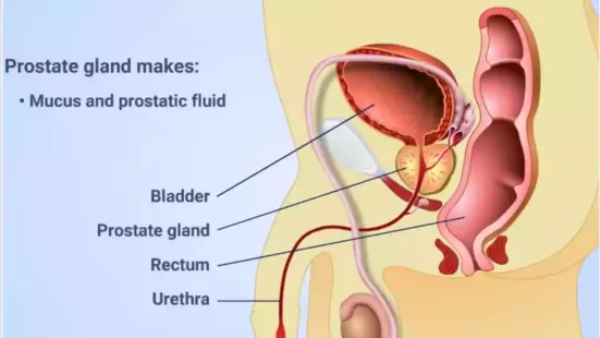 Prostate cancer is one of the most common cancers affecting men worldwide. It originates in the prostate gland, a small, walnut-sized organ located below the