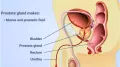 Prostate cancer is one of the most common cancers affecting men worldwide. It originates in the prostate gland, a small, walnut-sized organ located below the