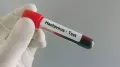 Following a hantavirus outbreak on the MV Hondius expedition cruise ship in early May, in which three deaths were reported and at least five others were