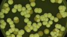 For a long time, fungal infections have meant itchy skin, discoloured nails and sometimes hair loss. These symptoms are collectively called dermatophytosis and