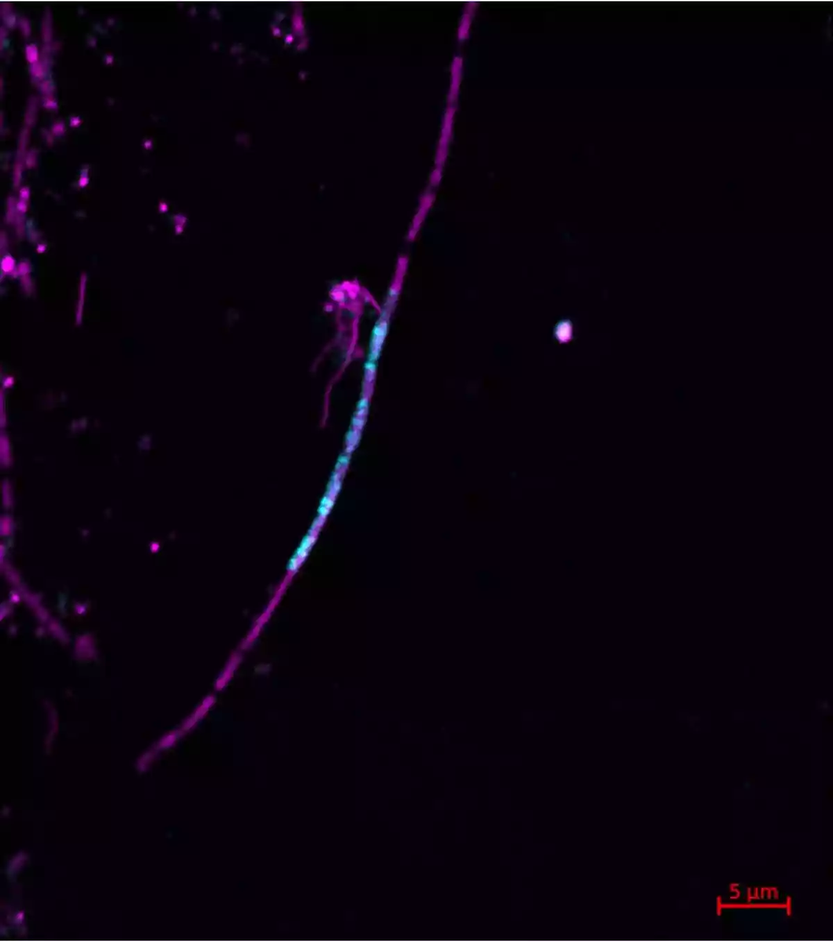 Why scientists watched a gene hop from a predator into its prey